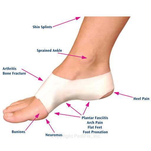 Pedifix P6065-STD3