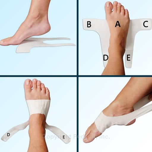Pedifix P6065-STD3